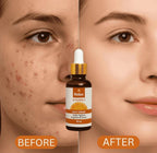 Relax Vitamin C Brightening Serum – 30ml